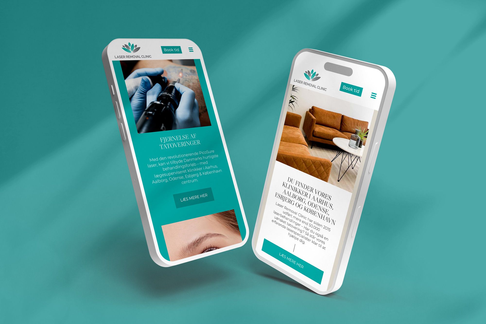 Billedet viser 2 telefoner med Laser Removal Clinics hjemmeside på